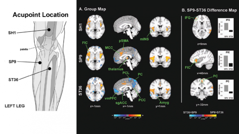 Napadow et al., Human Brain Mapping 2013 Acupuncture produces specific brain response, with activity in a subset of regions linked with peripheral autonomic outflow