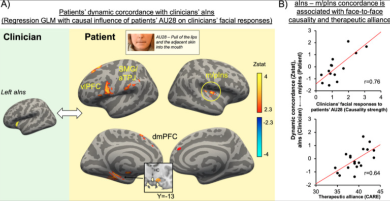 Ellingson et al.,Transl Psychiatry 2022 Patient-clinician brain concordance underlies causal dynamics in nonverbal communication and negative affective expressivity